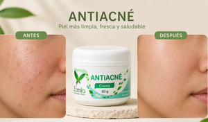 Crema Anti Acné