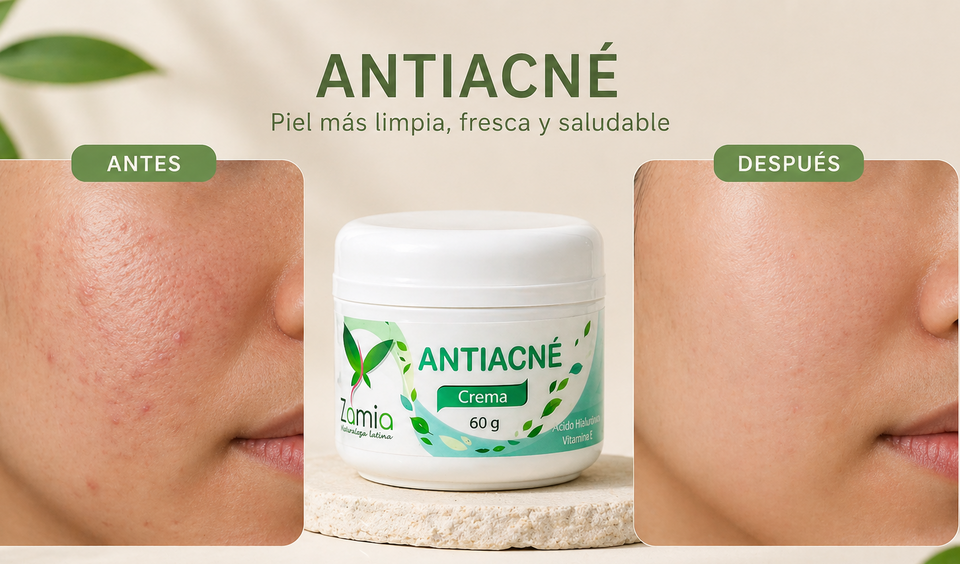 Crema Anti Acné
