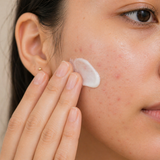 Crema Anti Acné